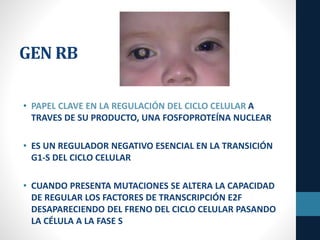 GEN RB
• PAPEL CLAVE EN LA REGULACIÓN DEL CICLO CELULAR A
TRAVES DE SU PRODUCTO, UNA FOSFOPROTEÍNA NUCLEAR
• ES UN REGULADOR NEGATIVO ESENCIAL EN LA TRANSICIÓN
G1-S DEL CICLO CELULAR
• CUANDO PRESENTA MUTACIONES SE ALTERA LA CAPACIDAD
DE REGULAR LOS FACTORES DE TRANSCRIPCIÓN E2F
DESAPARECIENDO DEL FRENO DEL CICLO CELULAR PASANDO
LA CÉLULA A LA FASE S
 
