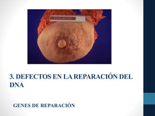3. DEFECTOS EN LAREPARACIÓN DEL
DNA
GENES DE REPARACIÓN
 