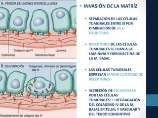 • INVASIÓN DE LA MATRÍZ
• SEPARACIÓN DE LAS CÉLULAS
TUMORALES ENTRE SÍ POR
DIMINUCIÓN DE LA E-
CADHERINA
• RECEPTORES DE LAS CÉLULAS
TUMORALES SE FIJAN A LA
LAMININA Y FIBRONECTINA DE
LA M. BASAL
• LAS CÉLULAS TUMORALES
EXPRESAN MAYOR CANTIDAD DE
RECEPTORES
• SECRECIÓN DE COLAGENASA
POR LAS CÉLULAS
TUMORALES>>>DEGRADACIÓN
DEL COLÁGENO IV DE LA M.
BASAL EPITELIAL Y VASCULAR Y
DEL TEJIDO CONJUNTIVO
 