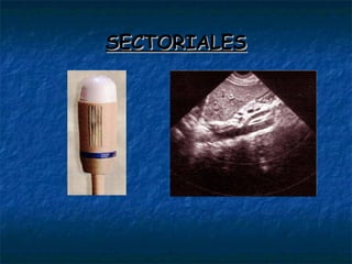 SECTORIALES 