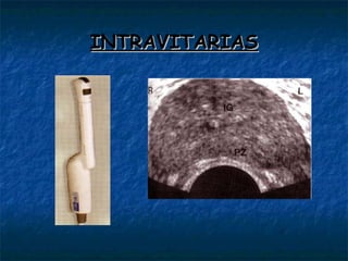 INTRAVITARIAS 