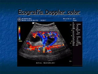 Ecografía Doppler color 
