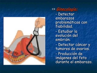 =>  Ginecología: - Detectar embarazos problemáticos con fiabilidad. - Estudiar la evolución del embrión. - Detectar cáncer y tumores de ovarios. - Producción de imágenes del feto durante el embarazo. 