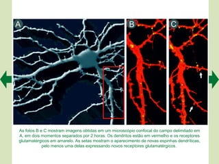 As fotos B e C mostram imagens obtidas em um microscópio confocal do campo delimitado em
A, em dois momentos separados por 2 horas. Os dendritos estão em vermelho e os receptores
glutamatérgicos em amarelo. As setas mostram o aparecimento de novas espinhas dendríticas,
            pelo menos uma delas expressando novos receptores glutamatérgicos.
 