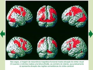 Nos cegos, a imagem de ressonância magnética funcional mostra ativação do córtex visual
(V) quando o indivíduo realiza uma leitura Braille, ao contrário do vidente, que praticamente
          só apresenta ativação das regiões somestésicas do córtex cerebral.
 