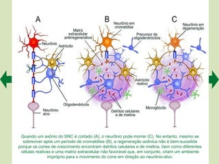 Quando um axônio do SNC é cortado (A), o neurônio pode morrer (C). No entanto, mesmo se
  sobreviver após um período de cromatólise (B), a regeneração axônica não é bem-sucedida
porque os cones de crescimento encontram detritos celulares e de mielina, bem como diferentes
 células reativas e uma matriz extracelular não favorável que, em conjunto, criam um ambiente
                impróprio para o movimento do cone em direção ao neurônio-alvo.
 
