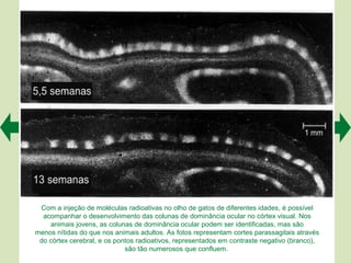 Com a injeção de moléculas radioativas no olho de gatos de diferentes idades, é possível
  acompanhar o desenvolvimento das colunas de dominância ocular no córtex visual. Nos
    animais jovens, as colunas de dominância ocular podem ser identificadas, mas são
menos nítidas do que nos animais adultos. As fotos representam cortes parassagitais através
 do córtex cerebral, e os pontos radioativos, representados em contraste negativo (branco),
                             são tão numerosos que confluem.
 