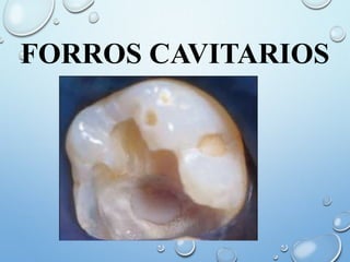 FORROS CAVITARIOS
 