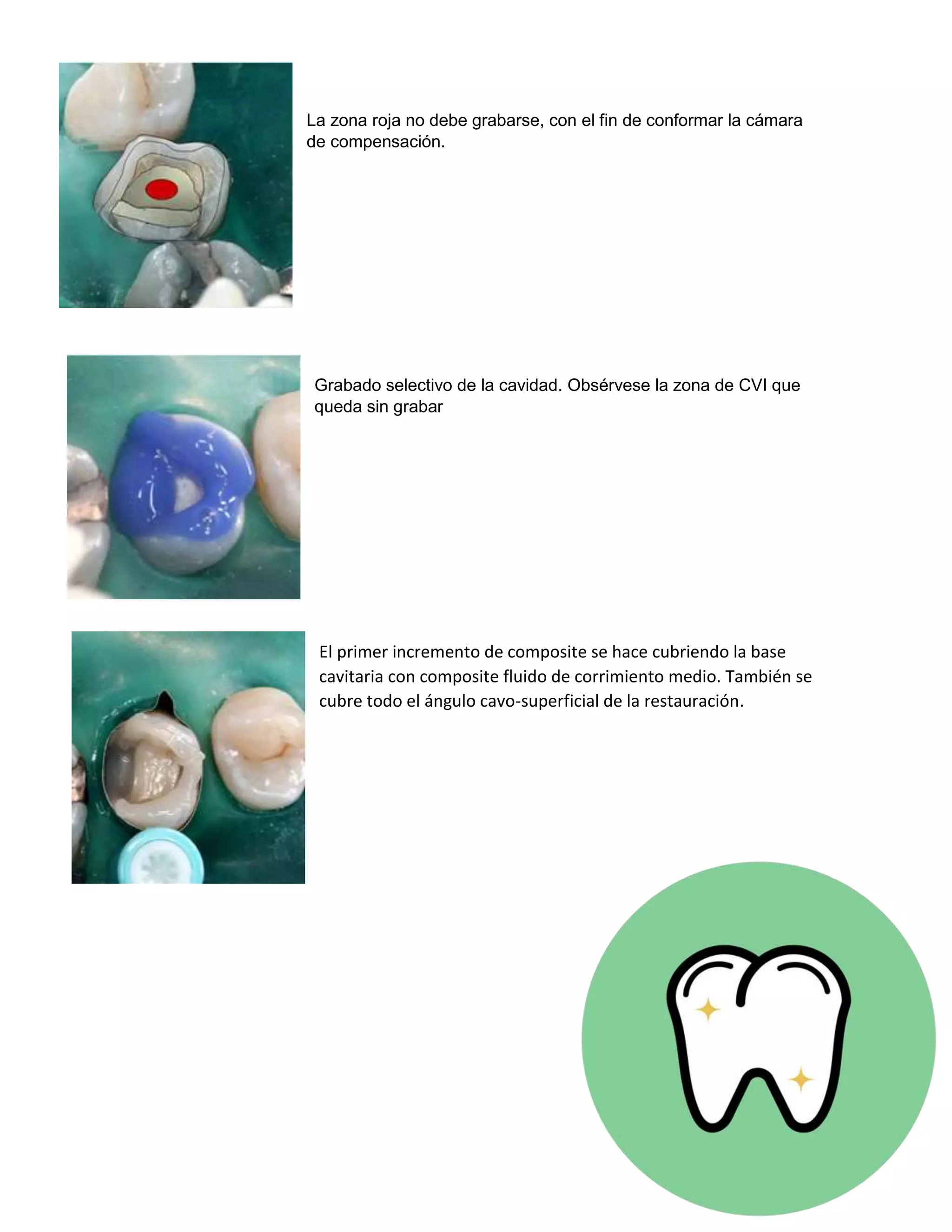 Bases cavitarias y cementos PDF