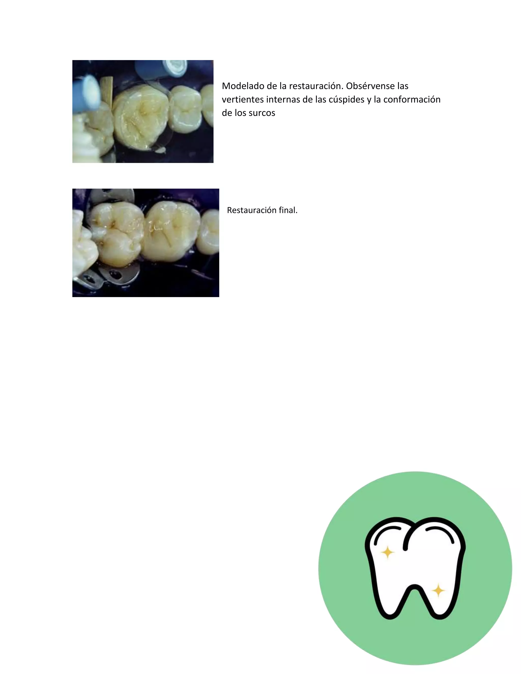 Bases cavitarias y cementos PDF