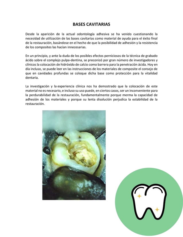 Bases cavitarias y cementos PDF