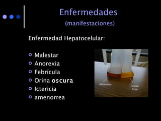 Enfermedades   (manifestaciones) Enfermedad Hepatocelular: Malestar Anorexia Febrícula Orina  oscura Ictericia amenorrea 