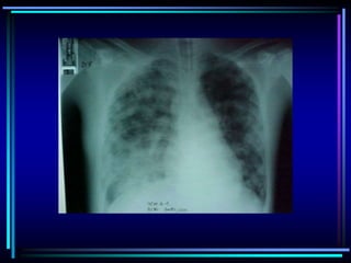 Bases de la VNI..ppt