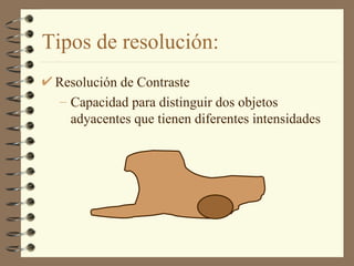 Tipos de resolución: Resolución de Contraste Capacidad para distinguir dos objetos adyacentes que tienen diferentes intensidades  