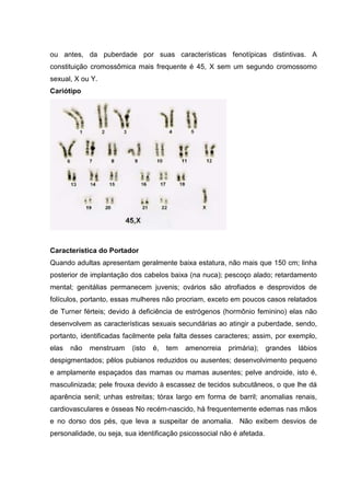 ou antes, da puberdade por suas características fenotípicas distintivas. A
constituição cromossômica mais frequente é 45, X sem um segundo cromossomo
sexual, X ou Y.
Cariótipo
Característica do Portador
Quando adultas apresentam geralmente baixa estatura, não mais que 150 cm; linha
posterior de implantação dos cabelos baixa (na nuca); pescoço alado; retardamento
mental; genitálias permanecem juvenis; ovários são atrofiados e desprovidos de
folículos, portanto, essas mulheres não procriam, exceto em poucos casos relatados
de Turner férteis; devido à deficiência de estrógenos (hormônio feminino) elas não
desenvolvem as características sexuais secundárias ao atingir a puberdade, sendo,
portanto, identificadas facilmente pela falta desses caracteres; assim, por exemplo,
elas não menstruam (isto é, tem amenorreia primária); grandes lábios
despigmentados; pêlos pubianos reduzidos ou ausentes; desenvolvimento pequeno
e amplamente espaçados das mamas ou mamas ausentes; pelve androide, isto é,
masculinizada; pele frouxa devido à escassez de tecidos subcutâneos, o que lhe dá
aparência senil; unhas estreitas; tórax largo em forma de barril; anomalias renais,
cardiovasculares e ósseas No recém-nascido, há frequentemente edemas nas mãos
e no dorso dos pés, que leva a suspeitar de anomalia. Não exibem desvios de
personalidade, ou seja, sua identificação psicossocial não é afetada.
 