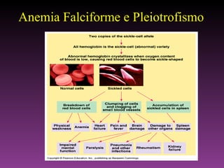 Anemia Falciforme e Pleiotrofismo 