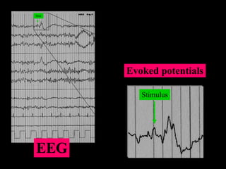 Stim Stimulus EEG Evoked potentials 
