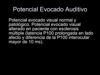 Potencial Evocado Auditivo Potencial evocado visual normal y patológico. Potencial evocado visual alterado en paciente con esclerosis múltiple (latencia P100 prolongada en lado afecto y diferencia de la P100 interocular mayor de 10 ms).   