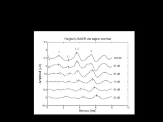 Variación de registros dependiente de intensidad 