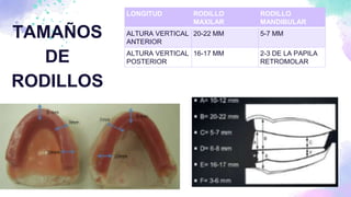 Bases y rodillos (1).pptx