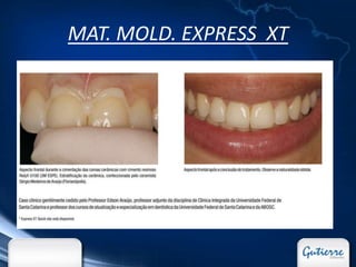 MAT. MOLD. EXPRESS XT
 