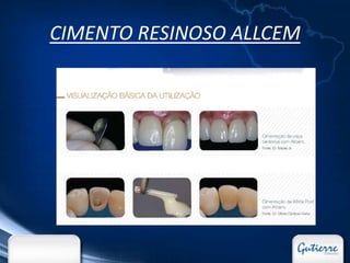 CIMENTO RESINOSO ALLCEM
 