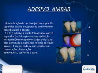 ADESIVO AMBAR

  4: A aplicação de um leve jato de ar por 10
segundos auxilia a evaporação do solvente e         4
contribui para a adesão.
 5 e 6: O adesivo é então fotoativado por 10
segundos (ou 20 segundos para aplicação
intracanal )Por fotopolimerizador de luz azul
                                                    5
com densidade de potência mínima de 400m
W/cm². A seguir, pode-se dar sequência à
restauração, cimentação
adesiva, etc., conforme o caso.
                                                6
 