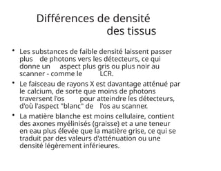 Différences de densité
des tissus
• Les substances de faible densité laissent passer
plus de photons vers les détecteurs, ce qui
donne un aspect plus gris ou plus noir au
scanner - comme le LCR.
• Le faisceau de rayons X est davantage atténué par
le calcium, de sorte que moins de photons
traversent l'os pour atteindre les détecteurs,
d'où l'aspect "blanc" de l'os au scanner.
• La matière blanche est moins cellulaire, contient
des axones myélinisés (graisse) et a une teneur
en eau plus élevée que la matière grise, ce qui se
traduit par des valeurs d'atténuation ou une
densité légèrement inférieures.
 