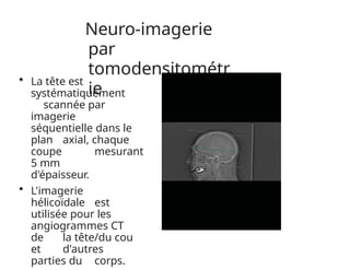 Neuro-imagerie
par
tomodensitométr
ie
• La tête est
systématiquement
scannée par
imagerie
séquentielle dans le
plan axial, chaque
coupe mesurant
5 mm
d'épaisseur.
• L'imagerie
hélicoïdale est
utilisée pour les
angiogrammes CT
de la tête/du cou
et d'autres
parties du corps.
 
