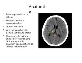 Anatomi
e
• Blanc - genu du corps
calleux
• Rouge - splénium
du corps calleux
• Jaune - thalamus
• Vert - plexus choroïde
dans le ventricule latéral
• Bleu - capsule externe
entre le cortex insulaire
latéralement et le
putamen des ganglions de
la base médialement
 