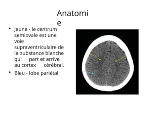 Anatomi
e
• Jaune - le centrum
semiovale est une
voie
supraventriculaire de
la substance blanche
qui part et arrive
au cortex cérébral.
• Bleu - lobe pariétal
 