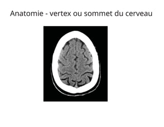 Anatomie - vertex ou sommet du cerveau
 