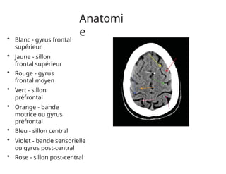 Anatomi
e
• Blanc - gyrus frontal
supérieur
• Jaune - sillon
frontal supérieur
• Rouge - gyrus
frontal moyen
• Vert - sillon
préfrontal
• Orange - bande
motrice ou gyrus
préfrontal
• Bleu - sillon central
• Violet - bande sensorielle
ou gyrus post-central
• Rose - sillon post-central
 