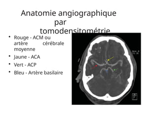 Anatomie angiographique
par
tomodensitométrie
• Rouge - ACM ou
artère cérébrale
moyenne
• Jaune - ACA
• Vert - ACP
• Bleu - Artère basilaire
 
