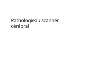 Pathologieau scanner
cérébral
 