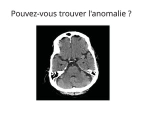Pouvez-vous trouver l'anomalie ?
 