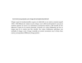 Comment est produite une image de tomodensitométrie3
Chaque coupe de tomodensitométrie acquise est subdivisée en une matrice contenant jusqu'à
1024 x 1024 éléments de volume (voxels). Chaque voxel a été traversé pendant le scan par de
nombreux photons de rayons X et l'intensité du rayonnement transmis a été mesurée par des
détecteurs. À partir de ces relevés d'intensité, la densité ou la valeur d'atténuation du tissu en
chaque point de la tranche peut être calculée. Des valeurs d'atténuation spécifiques sont
attribuées à chaque voxeL L'image visualisée est ensuite reconstruite sous la forme d'une
matrice correspondante d'éléments d'image (pixels).
 