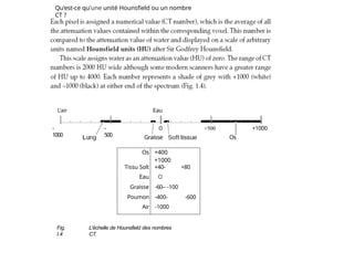 -
1000
-
500
+500 +1000
Graisse Os
Qu'est-ce qu'une unité Hounsfield ou un nombre
CT ?
L'air Eau
Os +400
+1000
Tissu Solt +40- +80
Eau O
Graisse -60-- -100
Poumon -400- -600
Air -1000
Fig.
I.4
L'échelle de Hounsfield des nombres
CT.
 