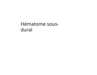 Hématome sous-
dural
 
