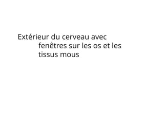Extérieur du cerveau avec
fenêtres sur les os et les
tissus mous
 