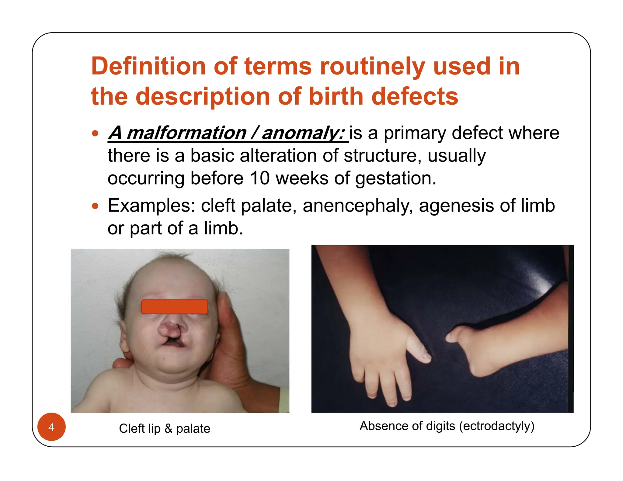 Basic-concepts-dysmorphology-Temtamy-2013.pdf