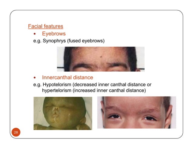 Basic-concepts-dysmorphology-Temtamy-2013.pdf | Pregnancy ...