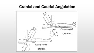 Cranial and Caudal Angulation
 