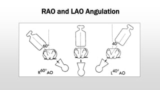 RAO and LAO Angulation
 