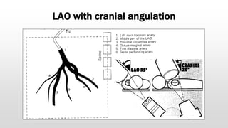 LAO with cranial angulation
 