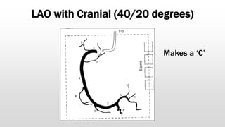 LAO with Cranial (40/20 degrees)
Makes a ‘C’
 