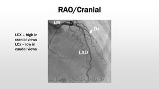RAO/Cranial
LAD
Dx
LCx
LM
LCX – high in
cranial views
LCx – low in
caudal views
 