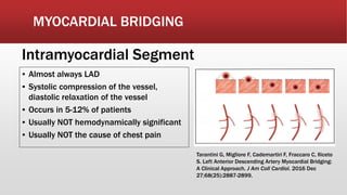 MYOCARDIAL BRIDGING
▪ Almost always LAD
▪ Systolic compression of the vessel,
diastolic relaxation of the vessel
▪ Occurs in 5-12% of patients
▪ Usually NOT hemodynamically significant
▪ Usually NOT the cause of chest pain
Intramyocardial Segment
Tarantini G, Migliore F, Cademartiri F, Fraccaro C, Iliceto
S. Left Anterior Descending Artery Myocardial Bridging:
A Clinical Approach. J Am Coll Cardiol. 2016 Dec
27;68(25):2887-2899.
 