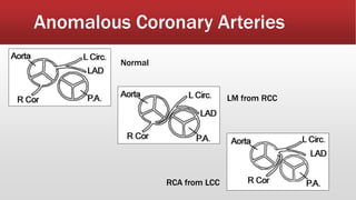 Anomalous Coronary Arteries
Normal
LM from RCC
RCA from LCC
 