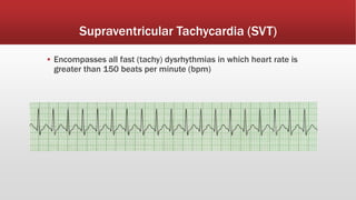 Tachy Fast Basic-EKG-Refresher.pdf